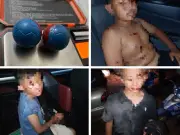 Polis Kedah Periksa Hospital Selepas Dakwaan Viral Kecederaan 'Mercun Bola' di Pendang