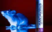 Hantavirus: Apa yang Anda Perlu Tahu Selepas Wabak Terkini