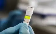 WHO sahkan 8 kes virus Andes dalam wabak hantavirus