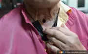 Derita Atuk Hilang Suara Akibat Kanser Peti Suara Walaupun Bukan Perokok